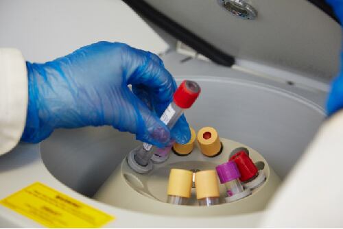 Control and diversity: How a novel multi-center model is improving food clinical trials