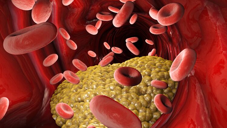 Cholesterol lowering aid? Swisse to run human clinical trial on practitioner-only formula