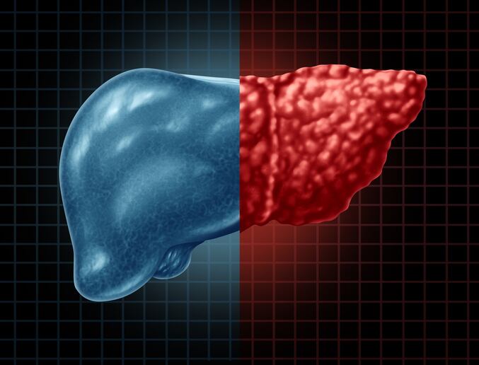 Mouse-study-finds-effects-for-little-studied-compound-geniposide-in-NAFLD.jpg