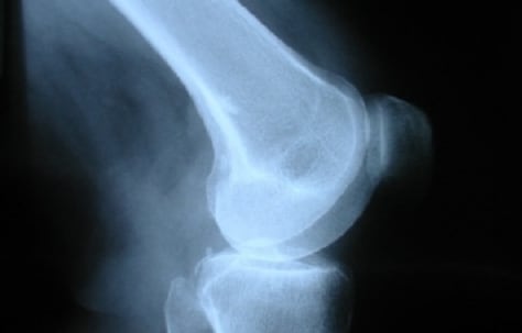 Collagen peptide impacts cardiovascular markers, study finds
