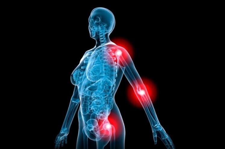 ASA ruling bans claims made for multi-nutrient joint supplement 