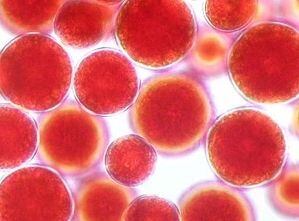 Red-Astaxanthin-cells-algatech.jpg