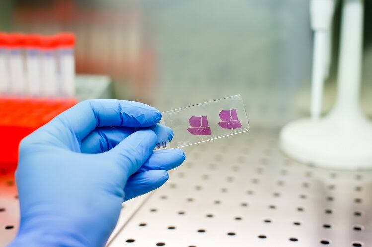 The gold standards for measuring liver health supplement efficacy in clinical trials