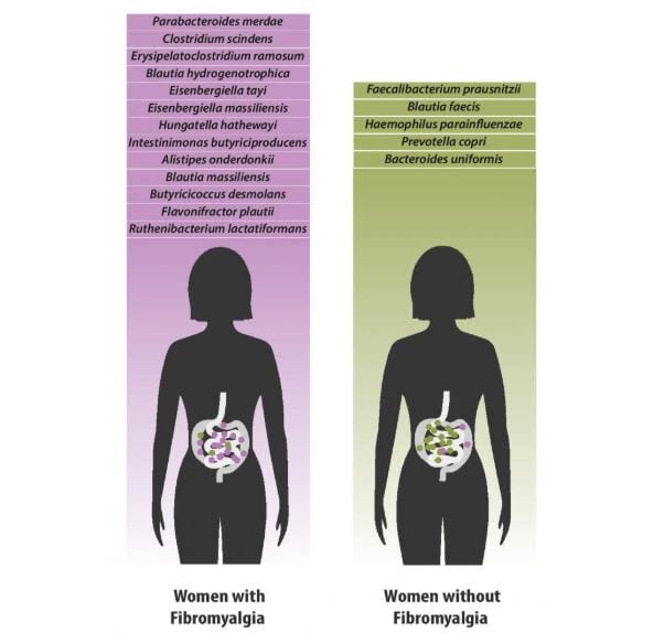 Gut-brain-axis-may-be-bridge-linking-chronic-pain-with-microbiome-changes.jpg