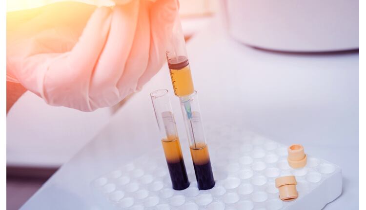 NMN oral intake shown safe and well metabolised for the first time – Oriental Yeast funded trial