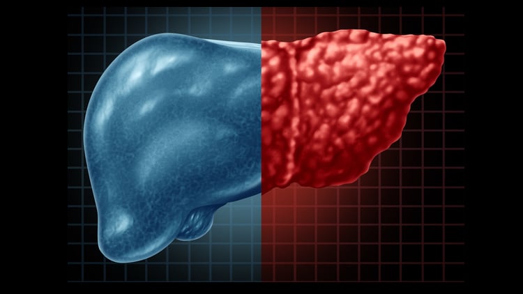 Centenarian-inspired: Metabolite supplementation shows benefits for fatty liver disease and weight management