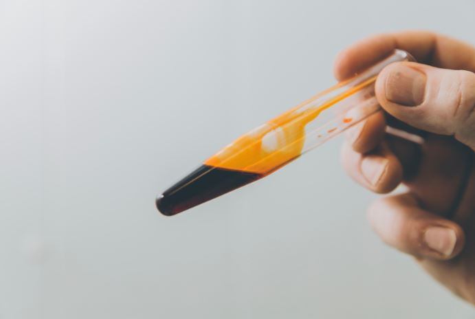 Commercial omega-3 harvesting expansion triggers Calanus’ €18m facility investment
