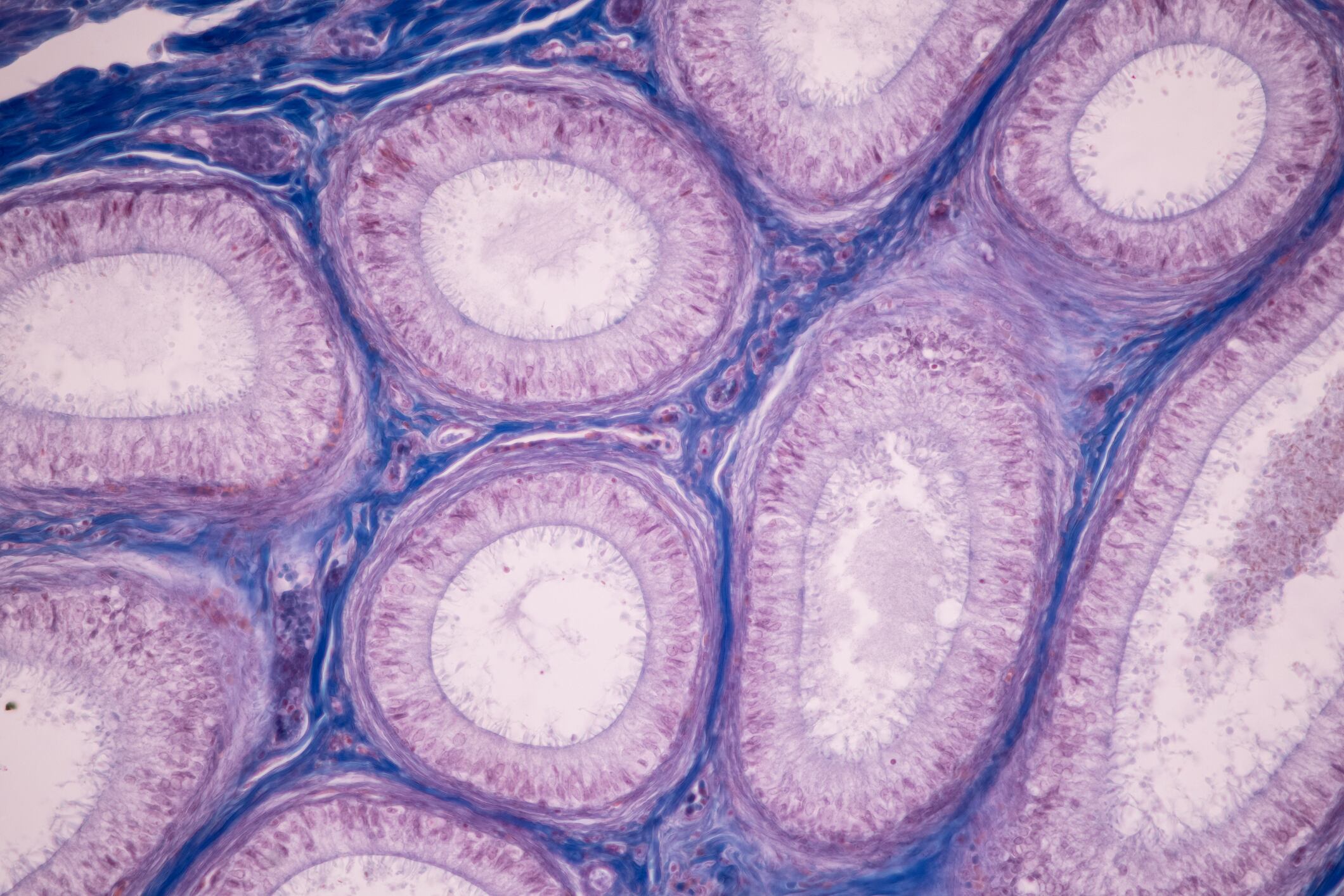 Anatomy and Histological Ovary human cells.