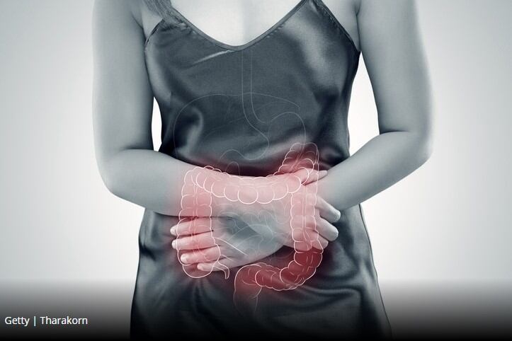 Gut health looks to have big say in cancer treatment success: Study