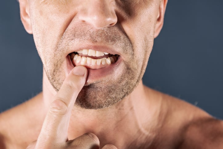 Active oral care: Danish willow bark specialist to conduct efficacy trials for chewing gum