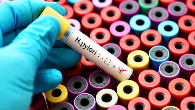 Vitamin B2 consumption may lower risk of H. pylori