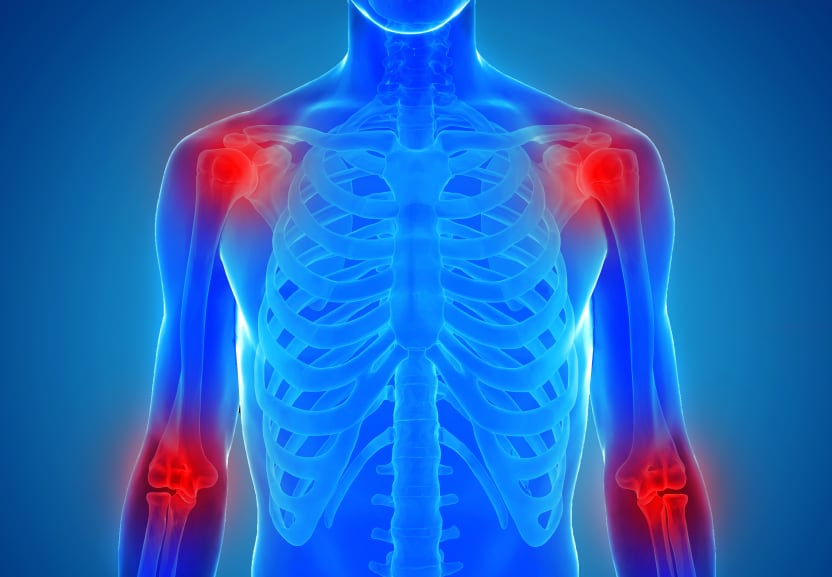 inflammation-joints-bone-iStock.com-goa_novi.jpg