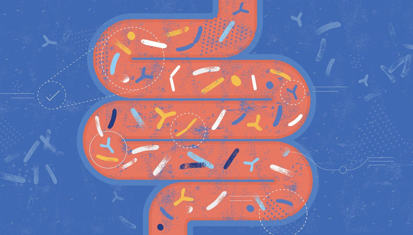 Postbiotic may protect against leaky gut: Study