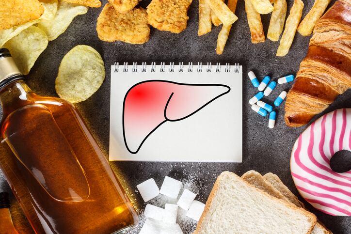 Review: Antioxidants and biotics offer benefits for MAFLD patients