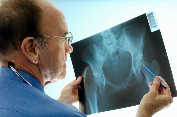 CRN-disputes-wide-ranging-conclusions-drawn-from-Vitamin-D-bone-health-analysis.jpg