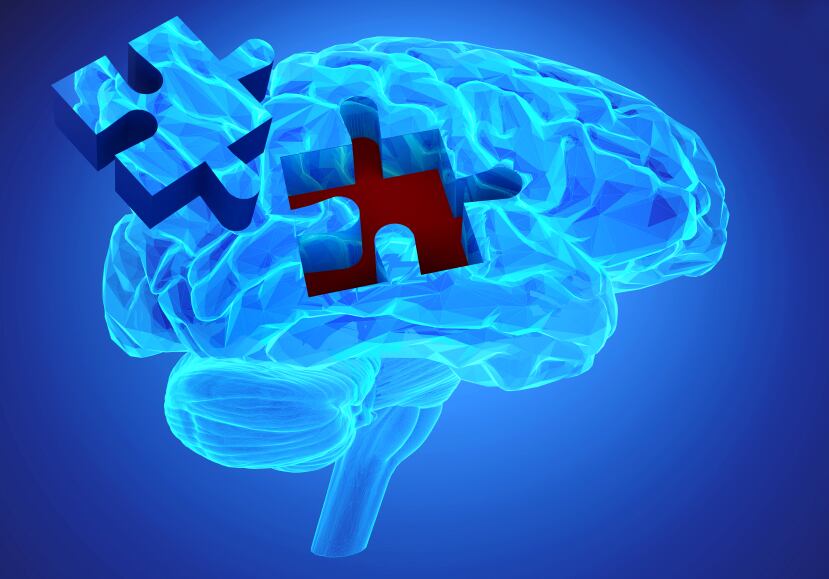 alzheimers-brain.jpg