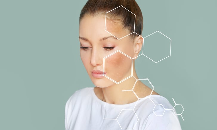'Double approach': Skin care brands launching oral supplements for anti-hyperpigmentation as awareness grows