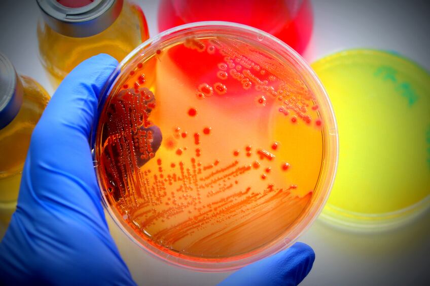 microbiology-probiotics-research-gut-vitro-iStock-Ca-ssis.jpg