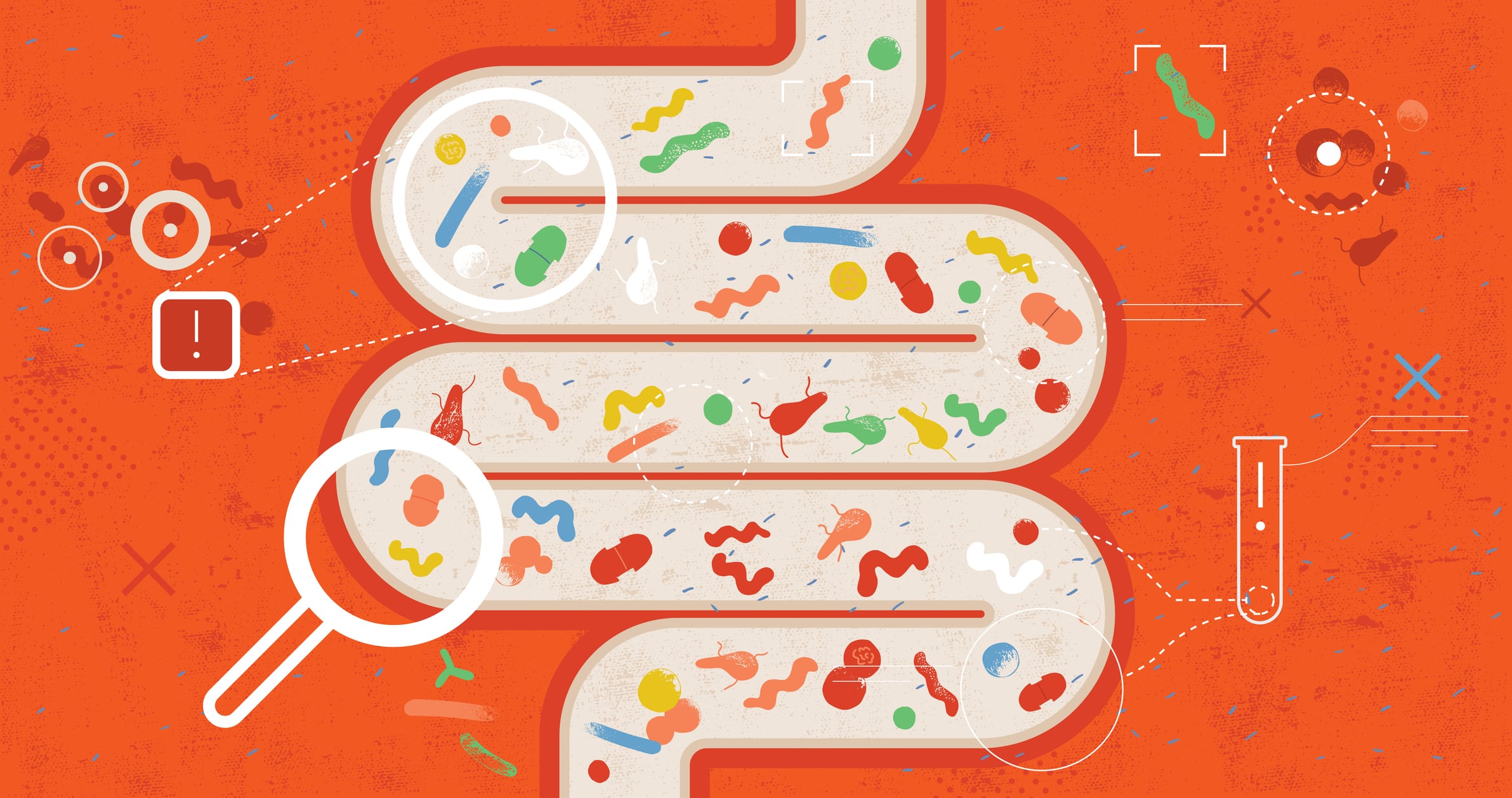 Biotic personalisation for the microbiome: is it worth it?