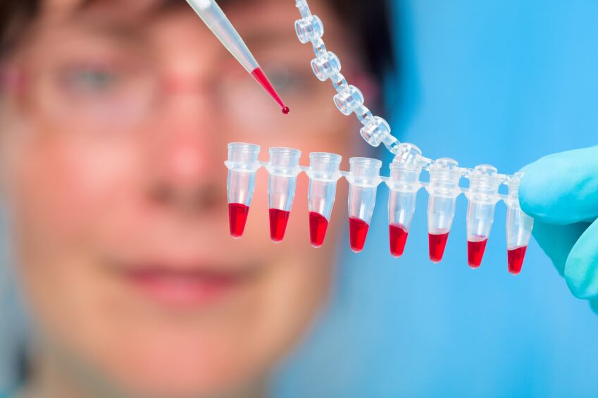 blood-sample-tests-research-iStock.com-luchschen.jpg