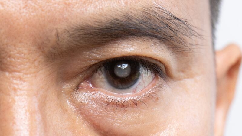 Vitamin E supplementation combined with high doses of vitamin B6 and niacin shows promise in reducing cataract risk – study