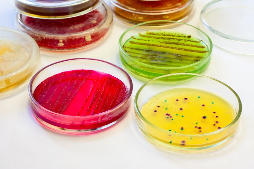 Bacteria_petridish_food_Safety_iStock.jpg