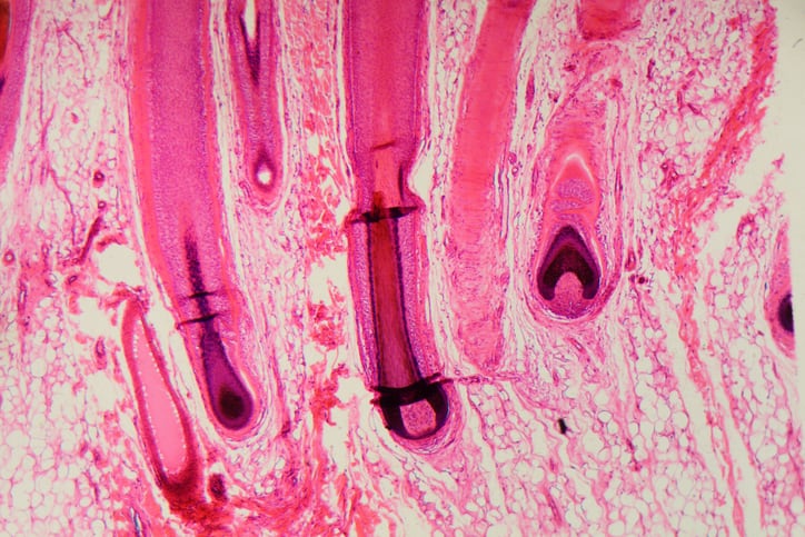 Microscopic view of a human hair follicle. New research into hair biology is helping shape the next generation of hair wellness products.