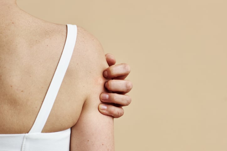 Probiotical-study-links-synbiotic-with-improvements-in-skin-conditions.jpg