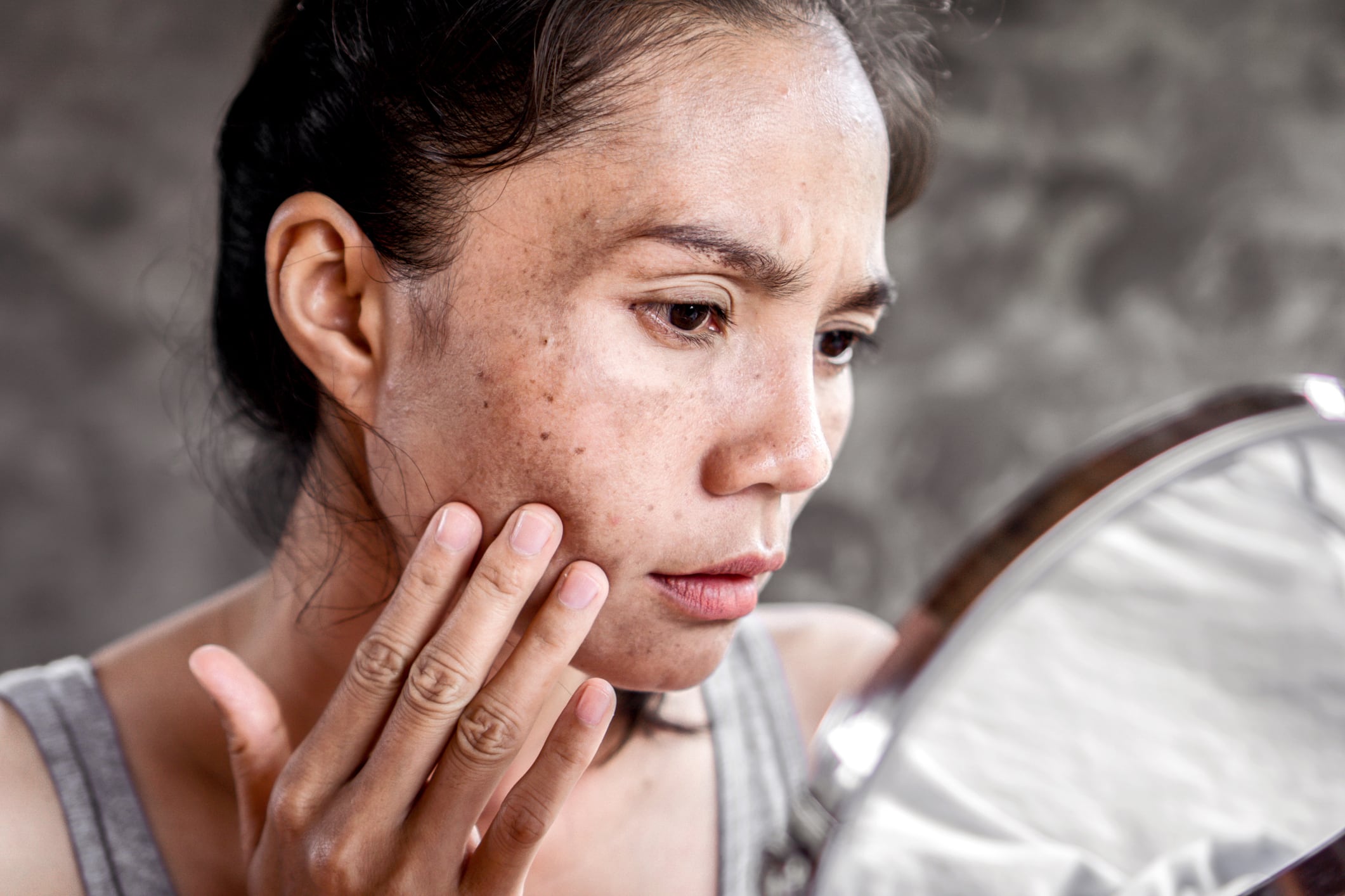 New-research-backed-supplement-to-lighten-dark-spots.jpg