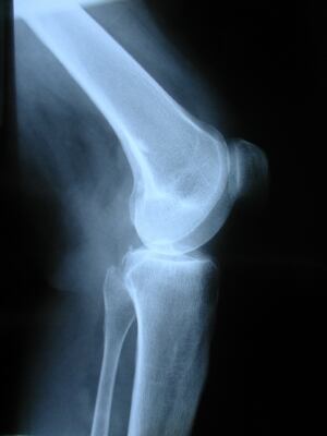 Knee.jpg