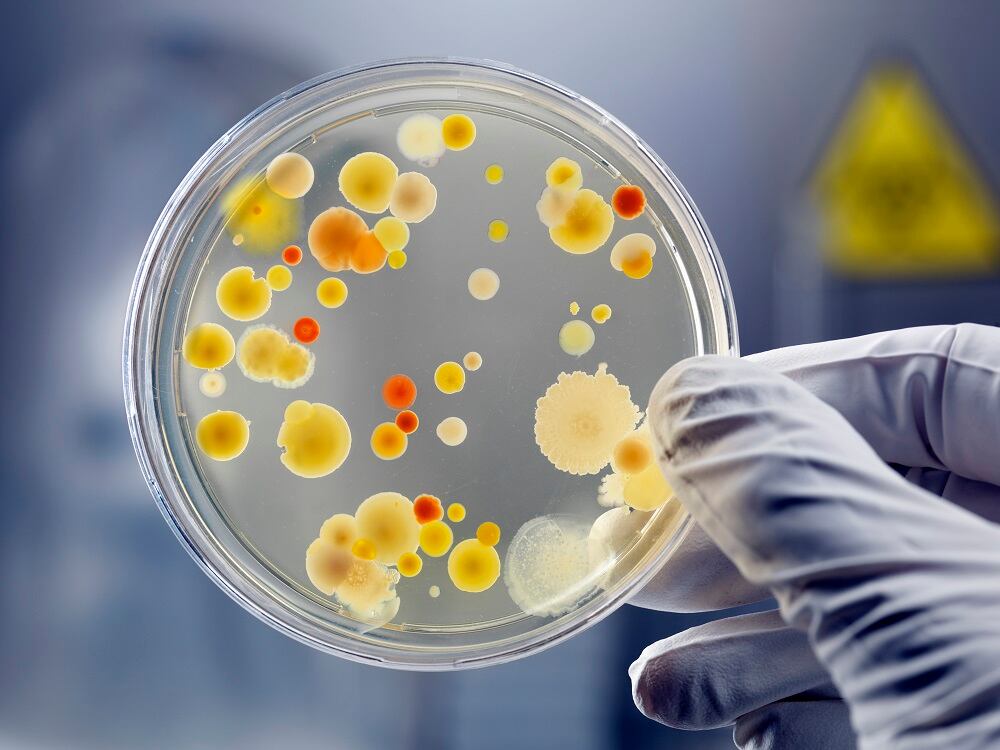 Agar plating methods have been used for many years to count probiotics and bacteria in general.