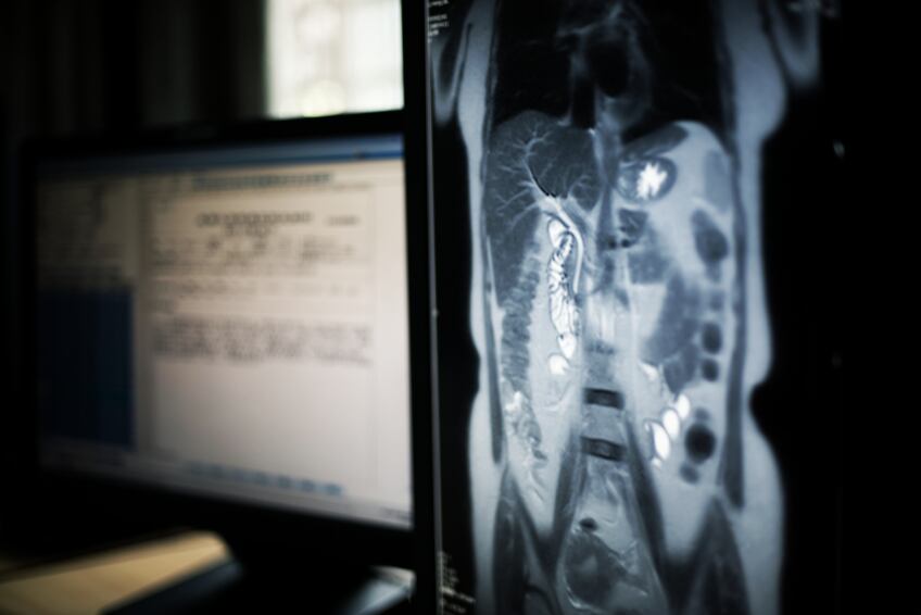 medical-liver.jpg