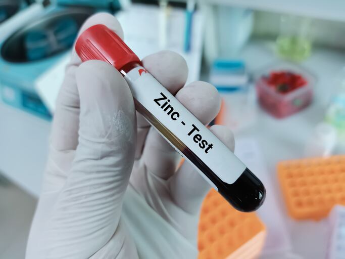 Call-to-action-over-zinc-The-most-insidious-of-all-deficiencies.jpg