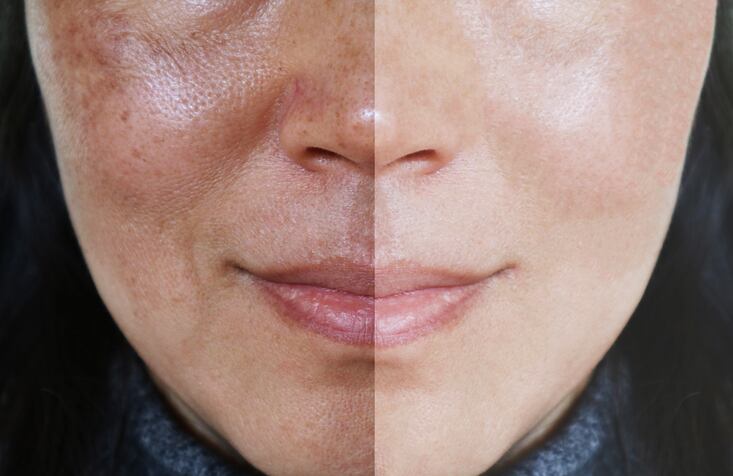 Study: Lifestyle, demographic factors account for some of the variations in skin, oral microbiomes