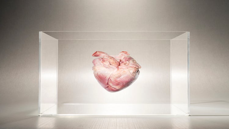 Omega-3-and-B-vitamins-could-improve-heart-disease.jpg