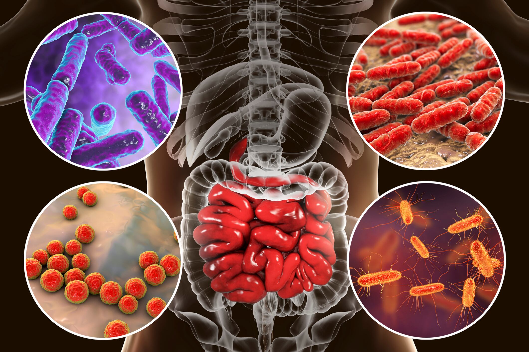 A credit score for your gut? Scientists develop index to distinguish between healthy and diseased microbiomes
