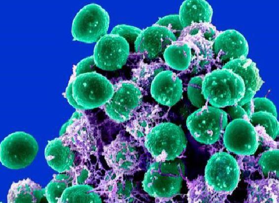 Bayer and Azitra partnership looks to develop skin microbiome products for eczema