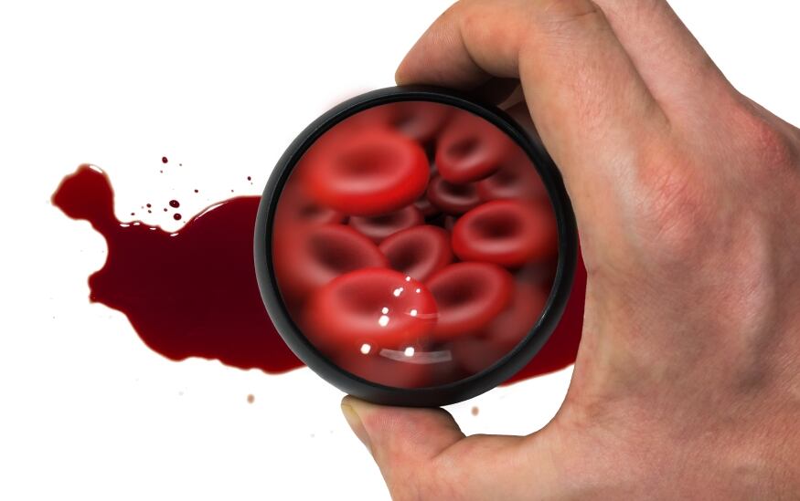 Probi’s ‘pregnancy probiotic’ proves potent in preventing anaemia 