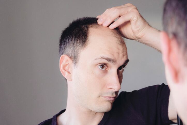 More-fat-means-less-hair-study-suggests.jpg