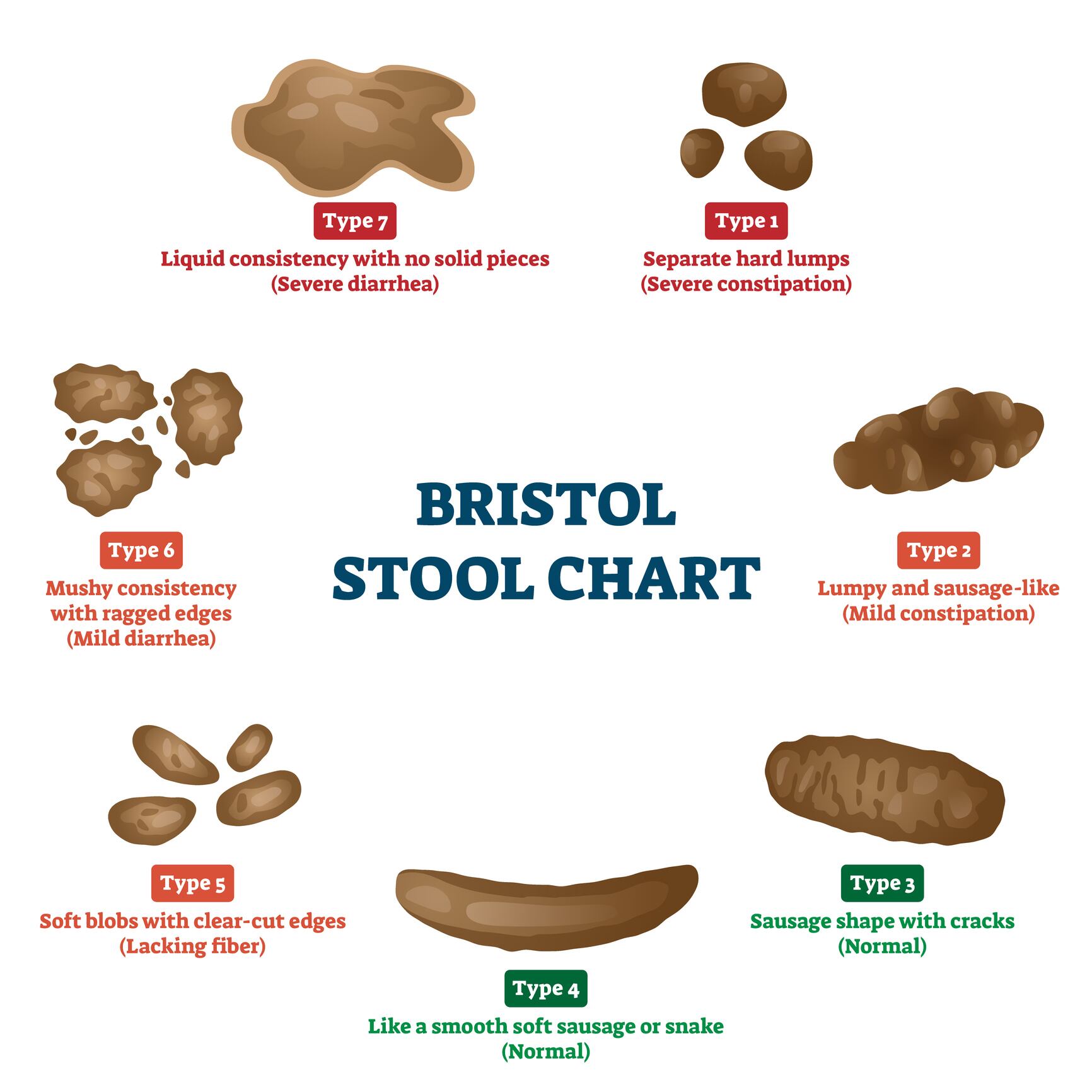 Bristol-Stool-Scale-C-VectorMine-Getty-Images.jpg