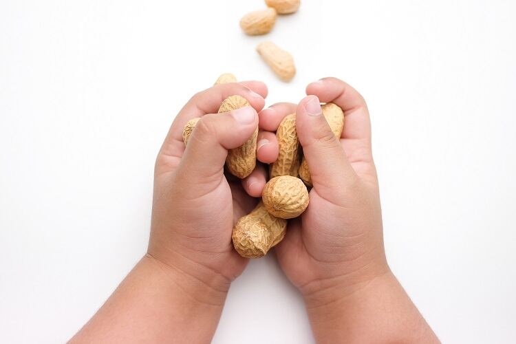 Early peanut exposure reduces allergy risk by 71%