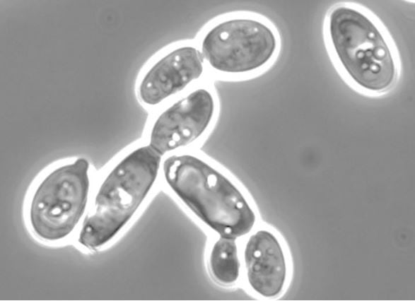EFSA-report-no-safety-concerns-in-supplemental-use-of-Yarrowia-lipolytica-yeast.jpg