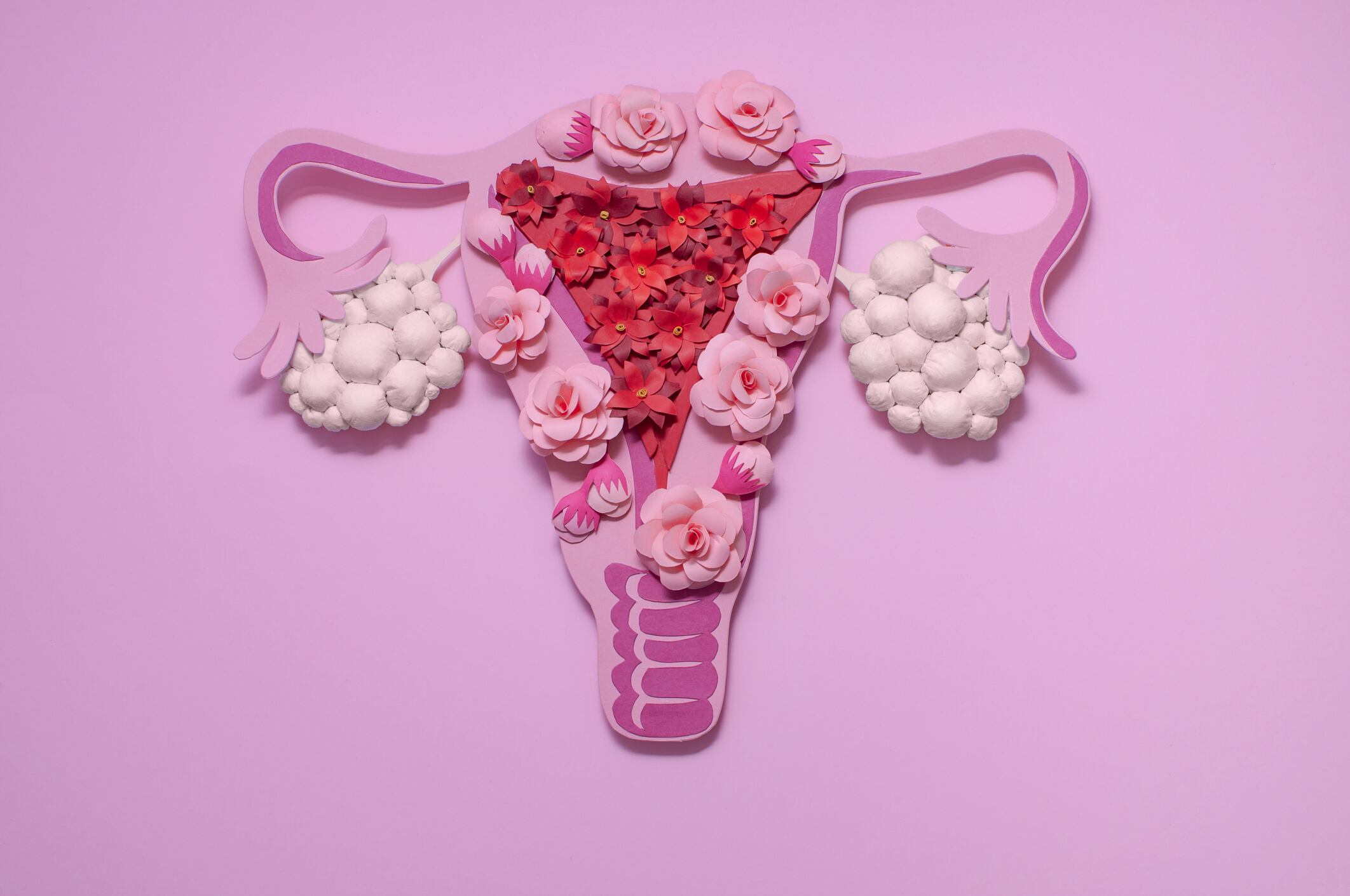 Concept polycystic ovary syndrome, PCOS. Paper art, awareness of PCOS, image of the female reproductive system