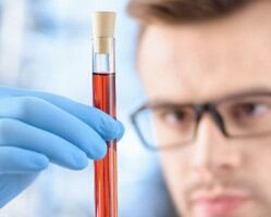 Specialized-services-could-be-lost-in-drive-toward-lab-consolidation-experts-say_wrbm_small.jpg