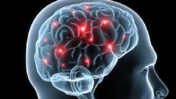 brain.jpg