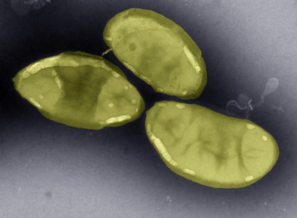 New gut species could improve protein availability, study finds