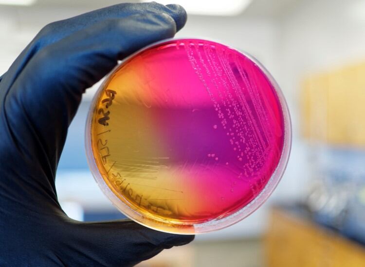 Salmonella: Lactalis criminally charged in France over infant formula recall