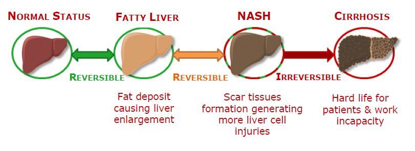 liver-2.jpg
