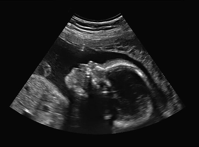 baby-scan.jpg