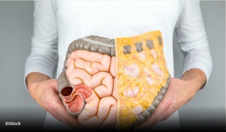 Polyphenol-based bacterial coating may promote “living biotherapeutics,” MIT says